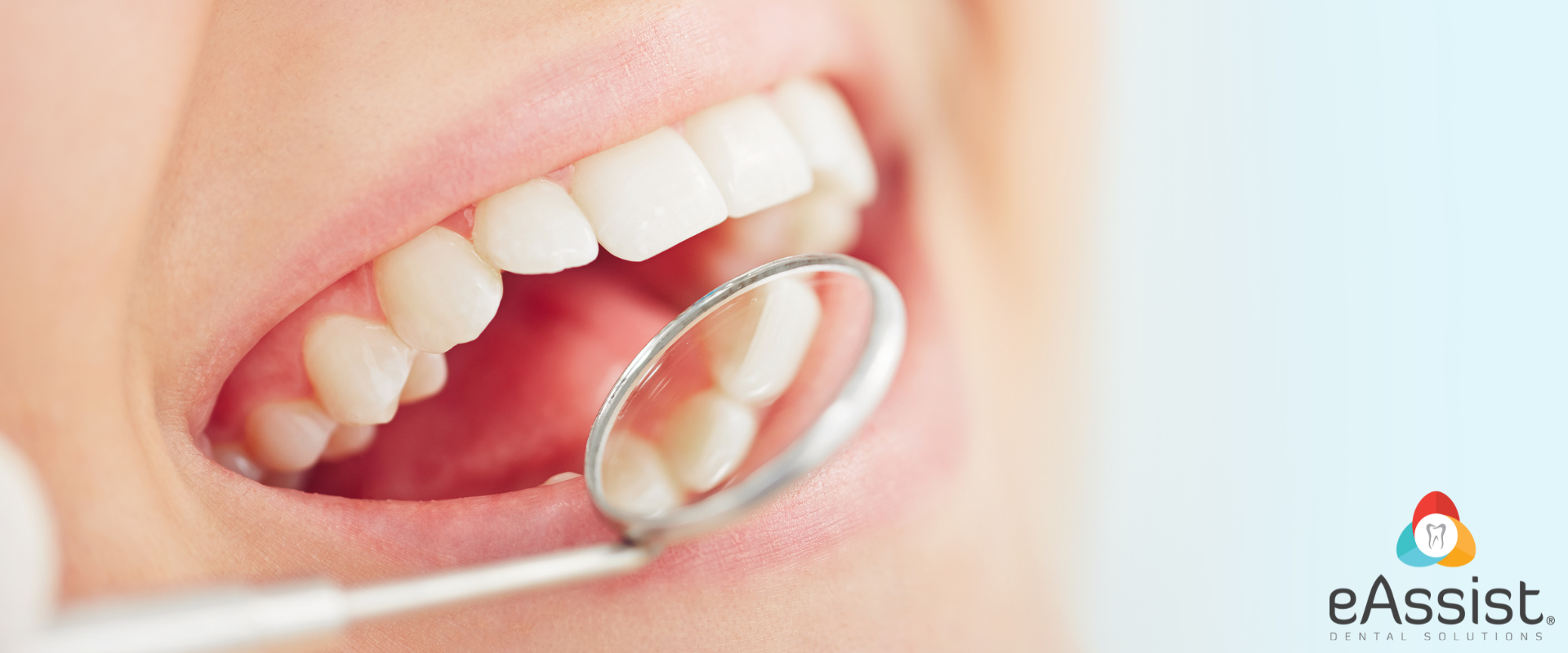 How to bill an occlusal guard 
